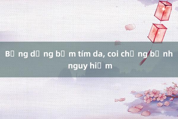 Bỗng dưng bầm tím da， coi chừng bệnh nguy hiểm